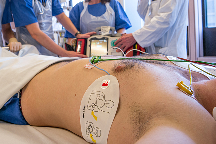 STROKE SIGNS TO LOOK OUT FOR